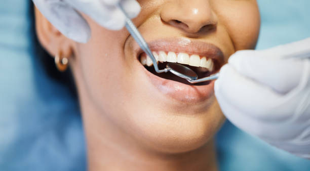 Best Urgent Care for Lost Fillings or Crowns in Apalachin, NY