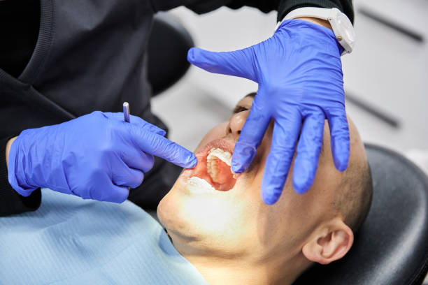Best Emergency Dental Care for Broken or Chipped Teeth in Apalachin, NY
